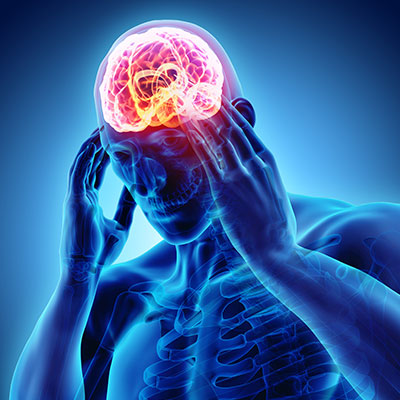 migraine headaches treatment in Minneapolis